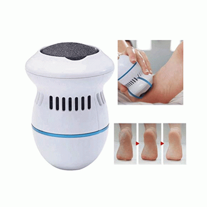 Electric Vacuum Foot Grinder - Image 3